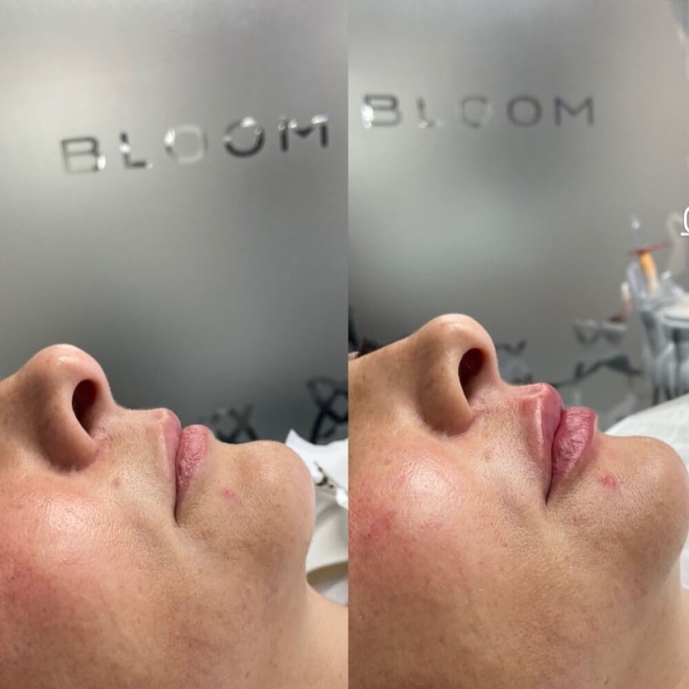 img antes e depois 1 (2) (1)