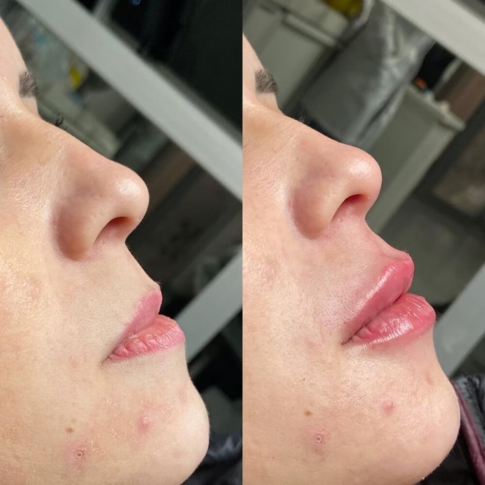 img antes e depois 2 (1)