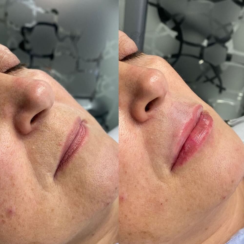 img antes e depois 3 (1)